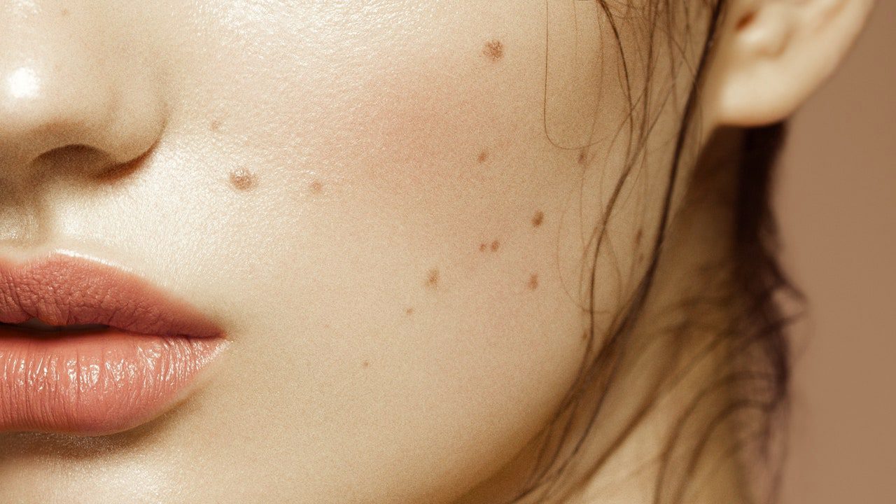 The Difference Between Beauty Marks and Moles