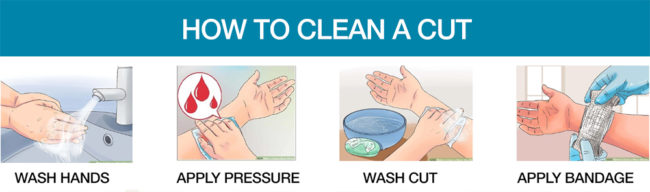 How to clean a wound